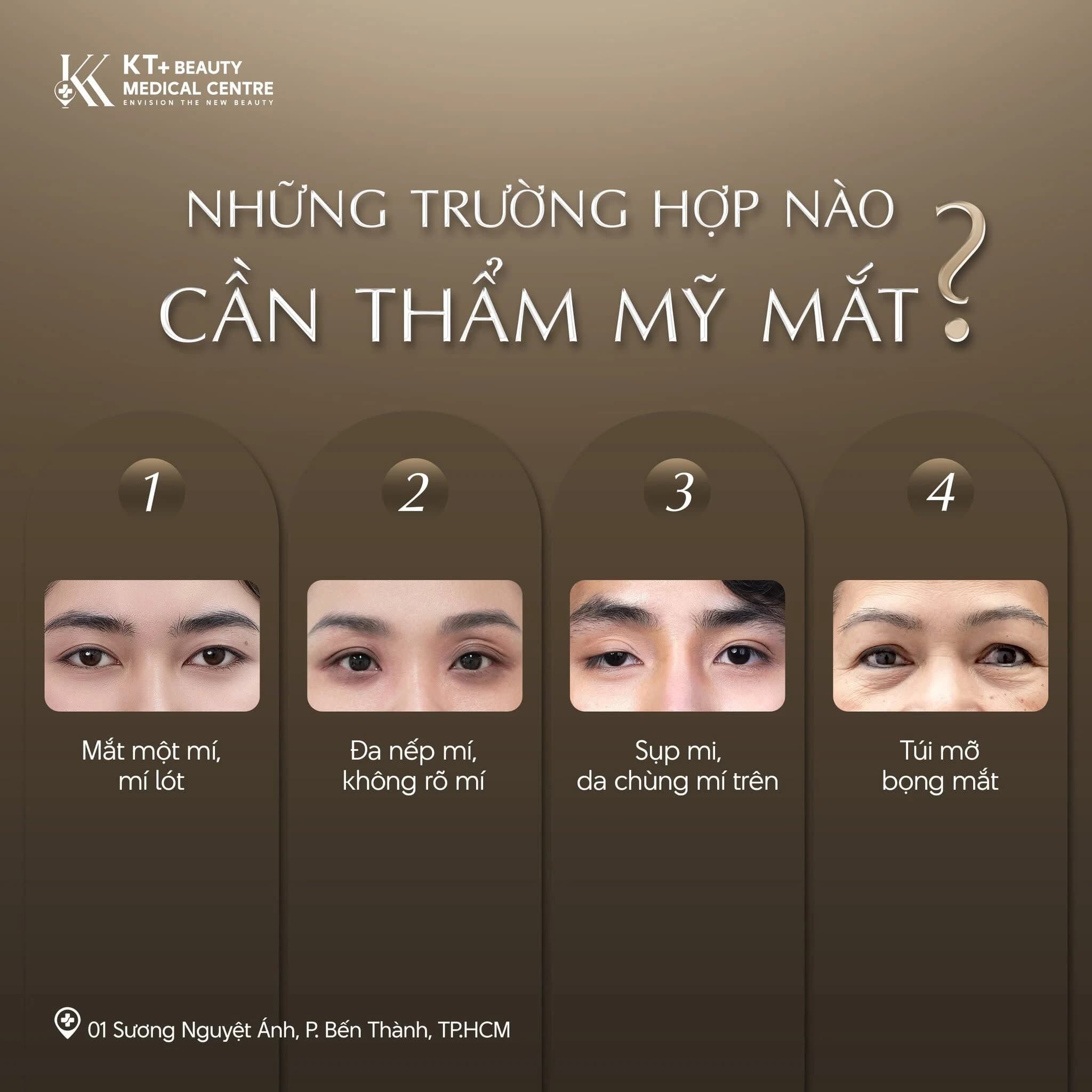 Thẩm mỹ vùng mắt: Khi nào cần can thiệp? Giải pháp phù hợp cho từng tình trạng