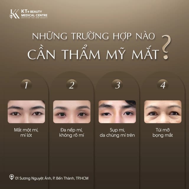 Thẩm mỹ vùng mắt: Khi nào cần can thiệp? Giải pháp phù hợp cho từng tình trạng